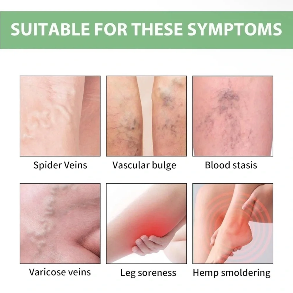 Varicose Veins Cream - Green Nourishing Leg Gel (50g) Lot Of 3 NEW